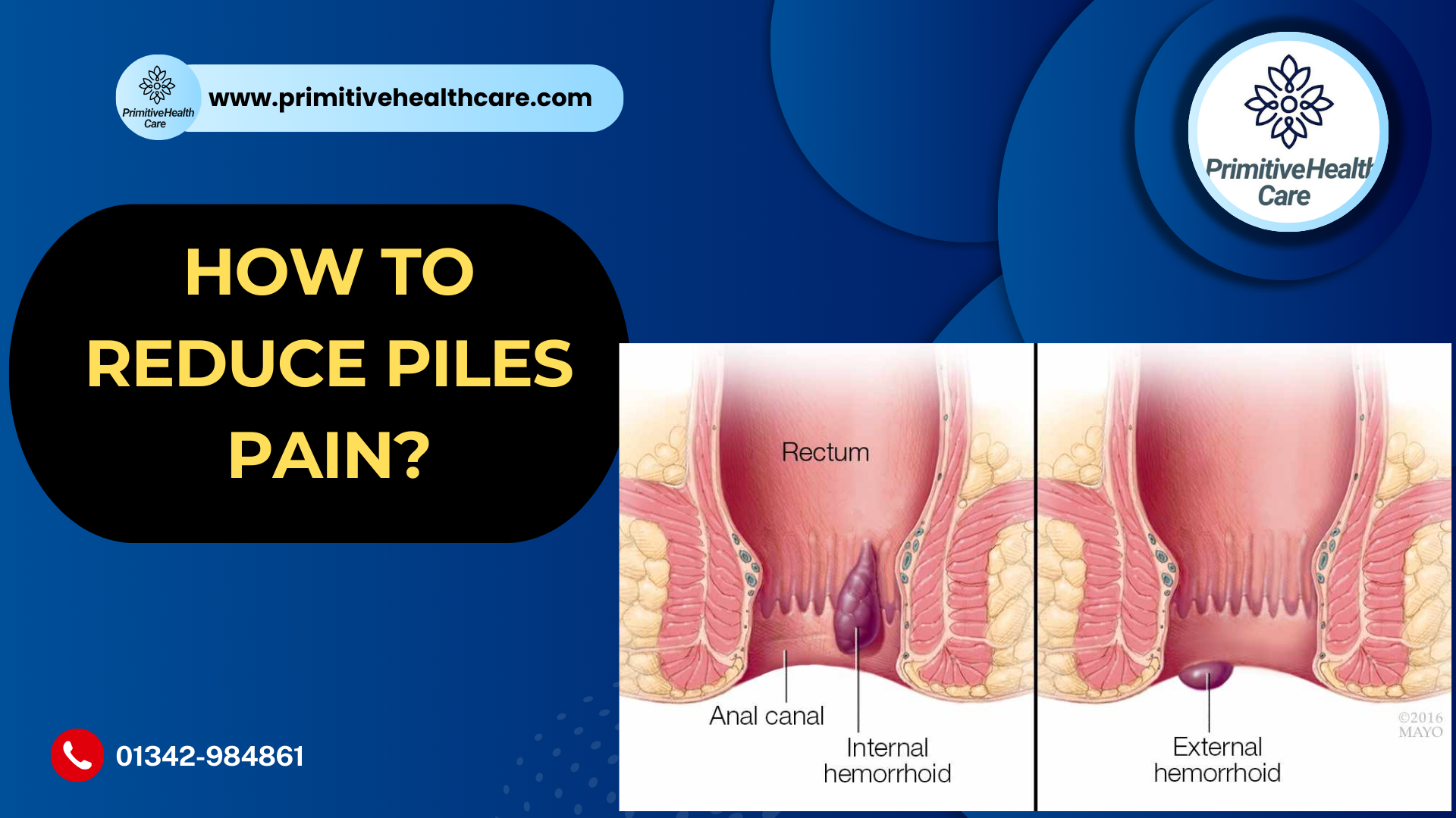 How to Reduce Piles Pain?